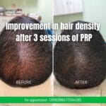 best hair specialist in bhubaneswar