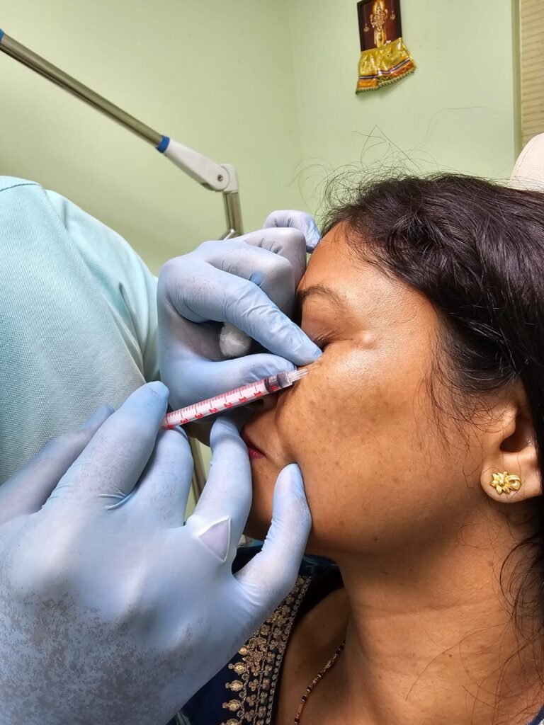 “Diagram showing Botox injection sites on the face.”