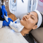 Acne Treatment in Bhubaneswar