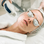 Acne Scar Surgery Treatment in Bhubaneswar