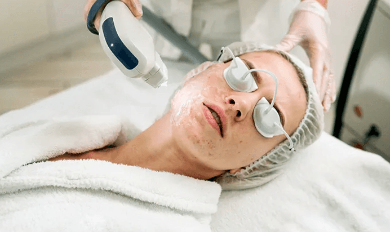 Acne Scar Surgery Treatment in Bhubaneswar