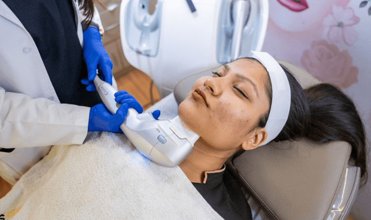 Acne Treatment in Bhubaneswar