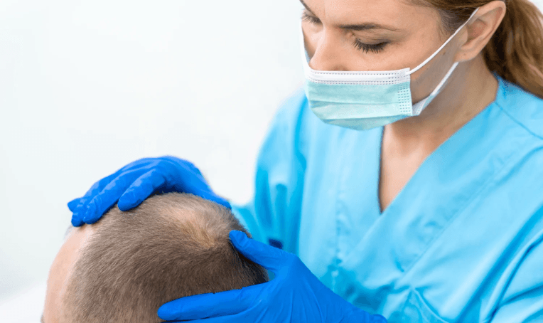 Androgenetic Alopecia Treatment in Bhubaneswar