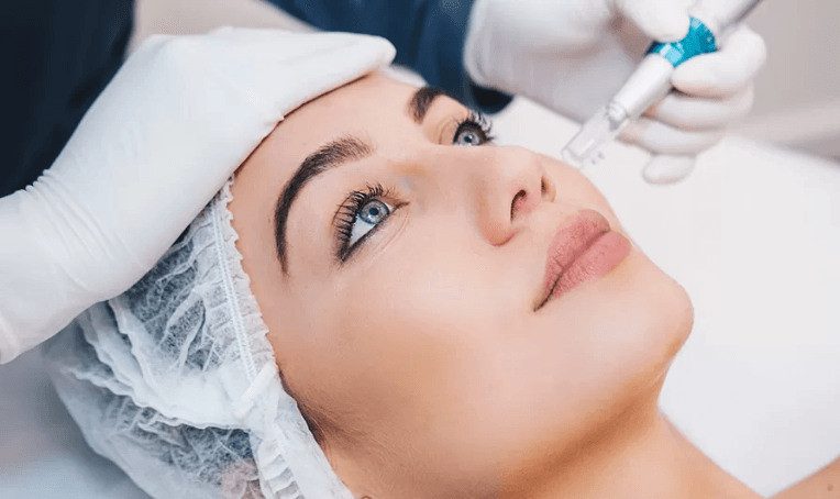 Micro Needling Treatment in Bhubaneswar