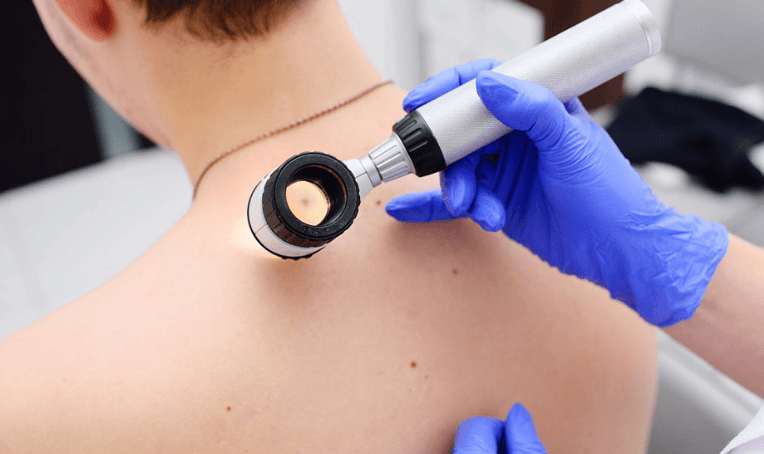 Dermoscopy Treatment in Bhubaneswar