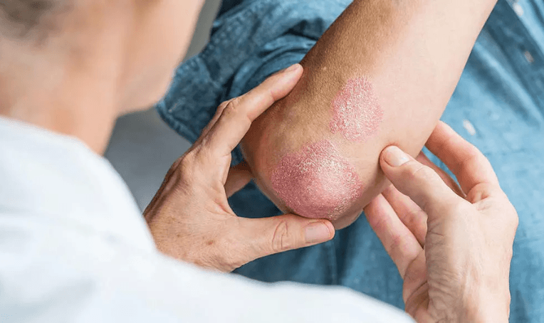 Venereologist Treatment in Bhubaneswar