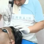 Advance Laser Treatment_3