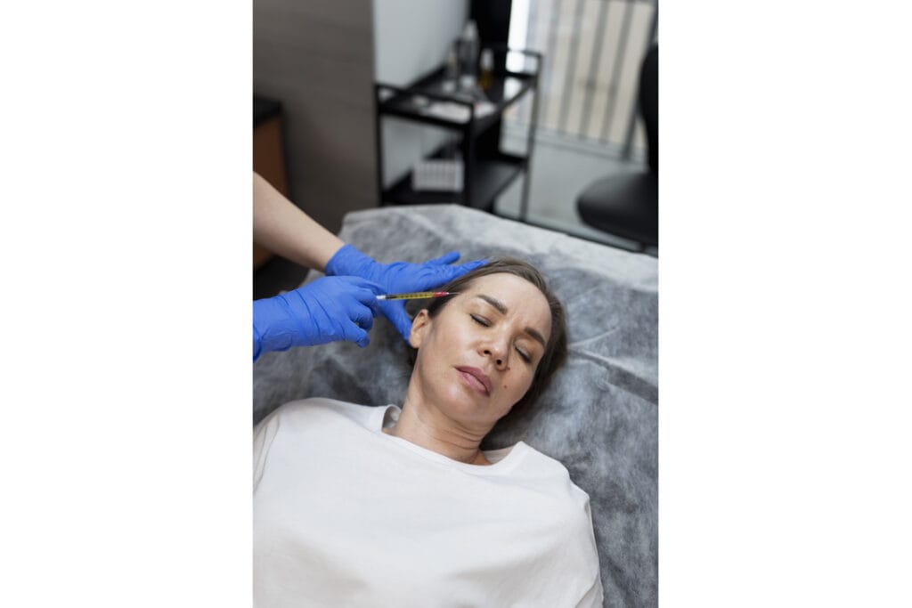 Woman receiving a professional microneedling treatment on forehead at a skin clinic