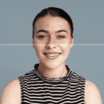 Acne Scar Surgery Treatment in Bhubaneswar: Which Surgical Option Is Right for Your Scar Type?